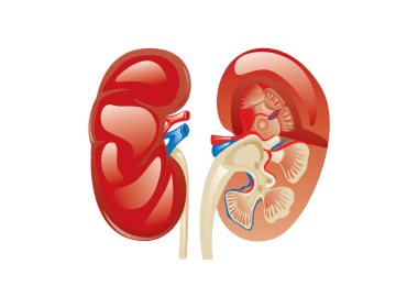 What is kidney transplant?
