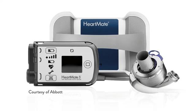 Everything you need to know before Ventricular Assist Device