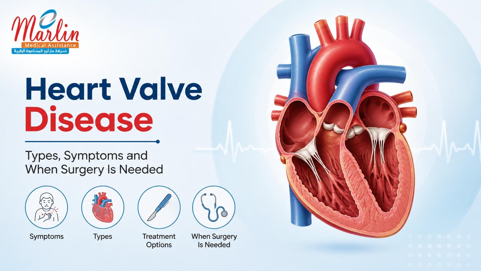 Article on Heart Valve Disease: Types, Symptoms and When Surgery Is Needed