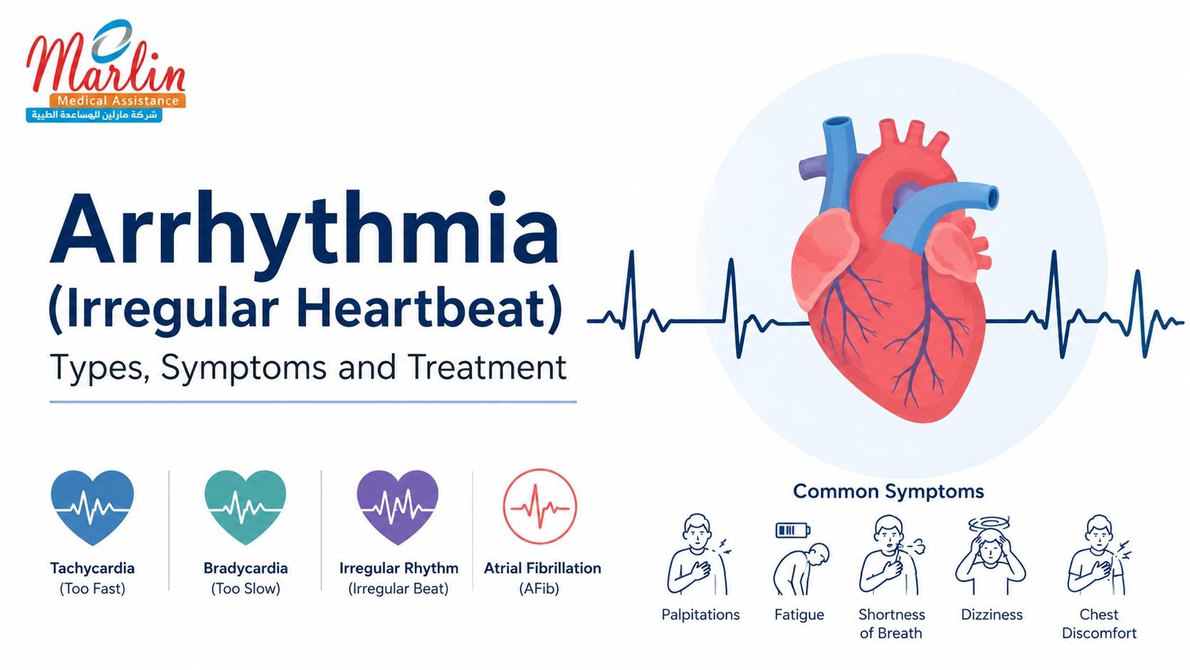 Article on Arrhythmia (Irregular Heartbeat): Types, Symptoms and Treatment