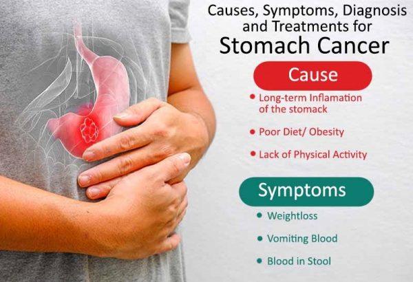 Article on Cancer Causes, Types, Treatment, Symptoms & Signs