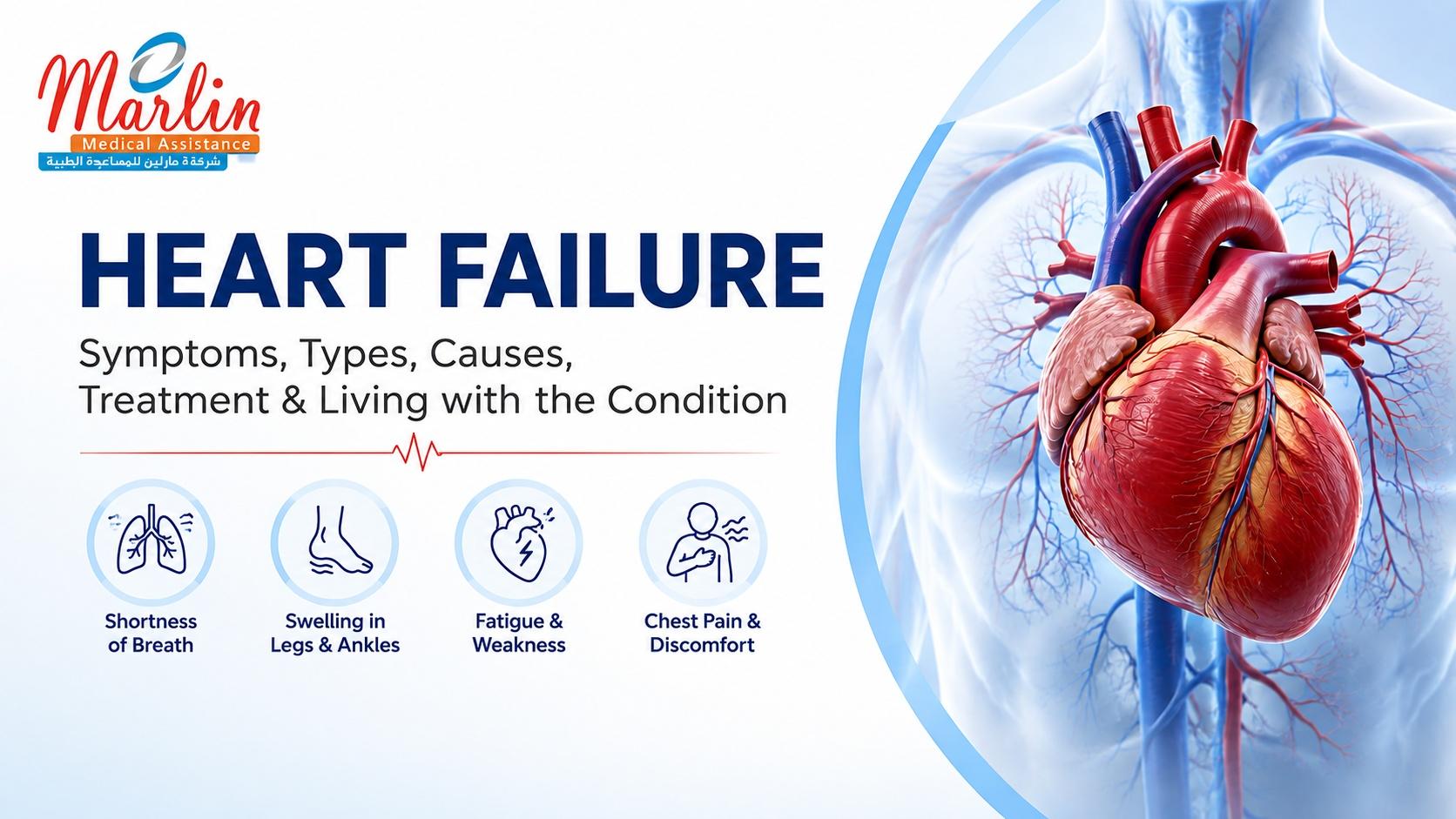 Article on Heart Failure: Symptoms, Types, Causes, Treatment & Living with the Condition