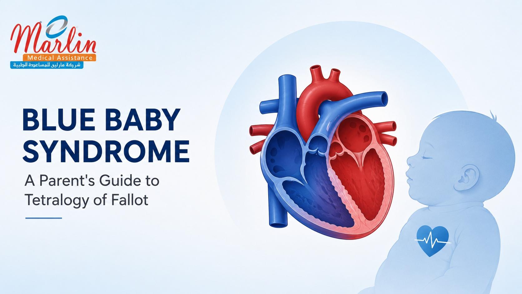 Article on Blue Baby Syndrome: A Parent's Guide to Tetralogy of Fallot