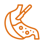 Bariatric & Metabolic Surgery Treatment Bariatric & Metabolic Surgery Treatment