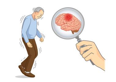 What is Parkinson's Disease?
