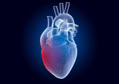 What is rheumatic heart disease?