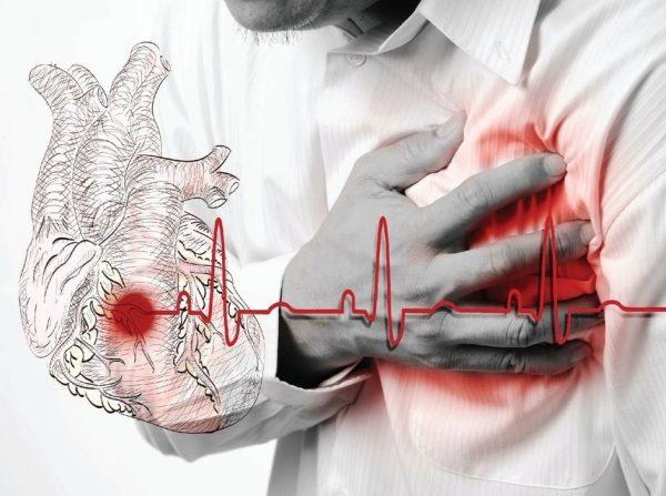 Article on A-Z Heart Problems and their Treatments