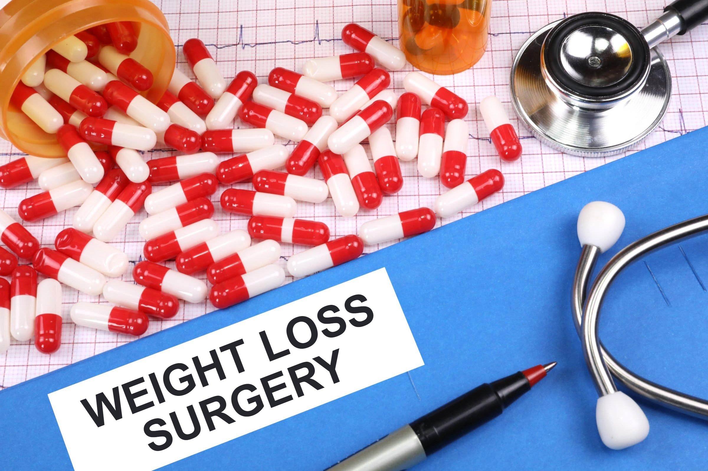 Article on WEIGHT LOSS SURGERY, BARIATRIC SURGERY, Sleeve Gastrectomy, and Gastric Bypass