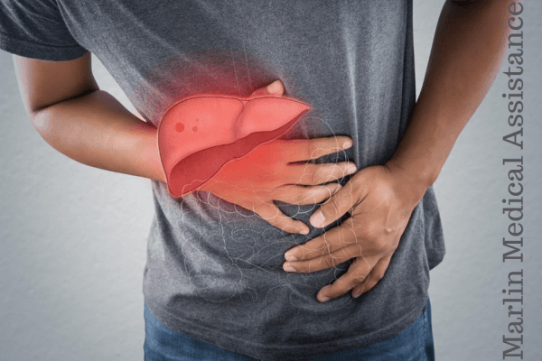 Article on LIVER TRANSPLANT–FACTS
