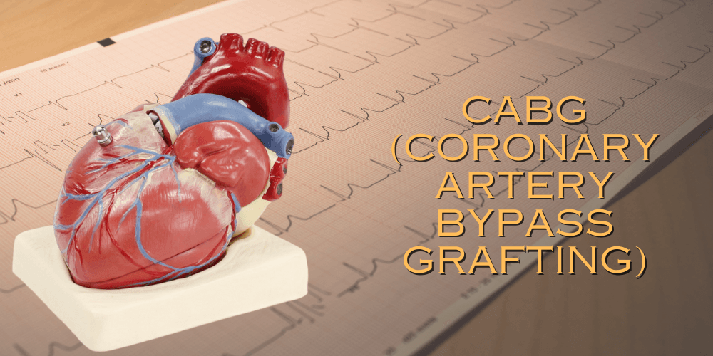 Article on Ready for the Bypass? Top Tips to know before CABG (Coronary Artery Bypass Grafting) Surgery
