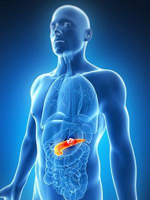 Article on What Is Pancreatic Cancer?