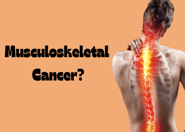 What is musculoskeletal cancer?
