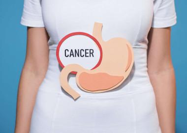 What is stomach cancer?